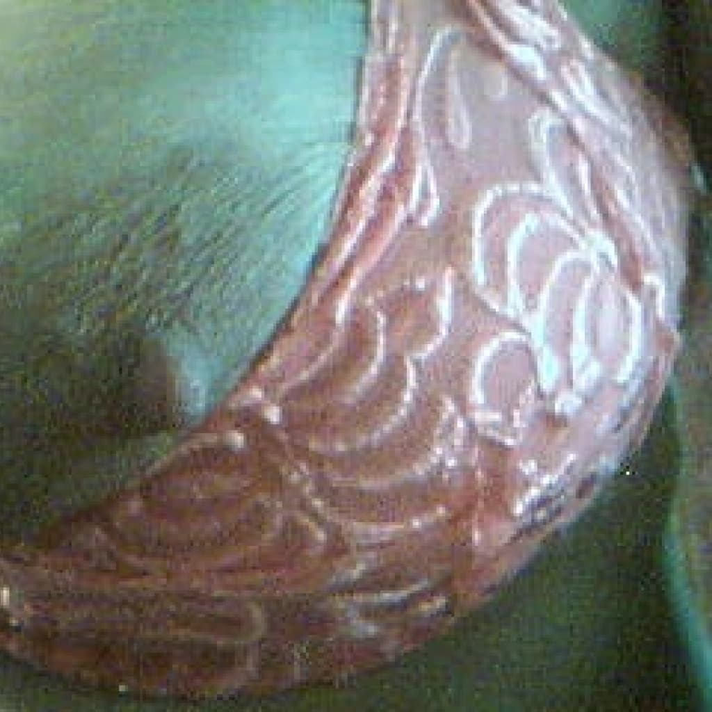 main